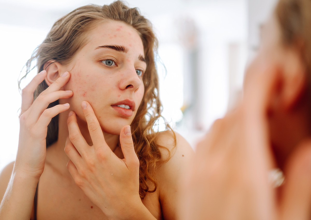 Imaginity, Adermicina, Diseño De Producto, Jabón De Limpieza Facial, Jabón, Target, Análisis, Desarrollo De Conceptos